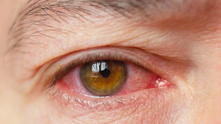 El extracto de baya de Maqui ha mostrado potencial en la mejora de la sequedad ocular